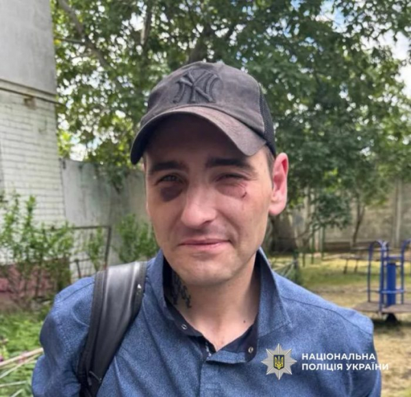 В Одеському районі оголосили &laquo;Сирену&raquo;: розшукують підозрюваного у крадіжці, який утік з-під варти